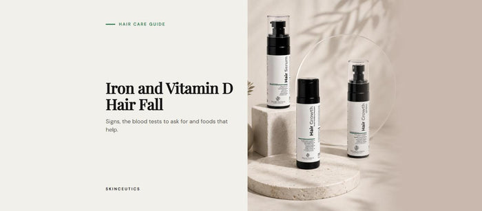 Iron and Vitamin D Deficiency Hair Fall: Signs, Tests and Diet Tips